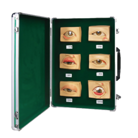 Common eye disease model (20pcs/set)